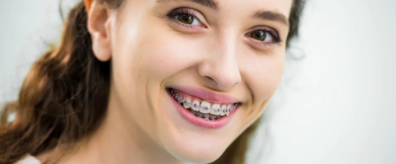 osoba z aparatem na zęby uśmiecha się