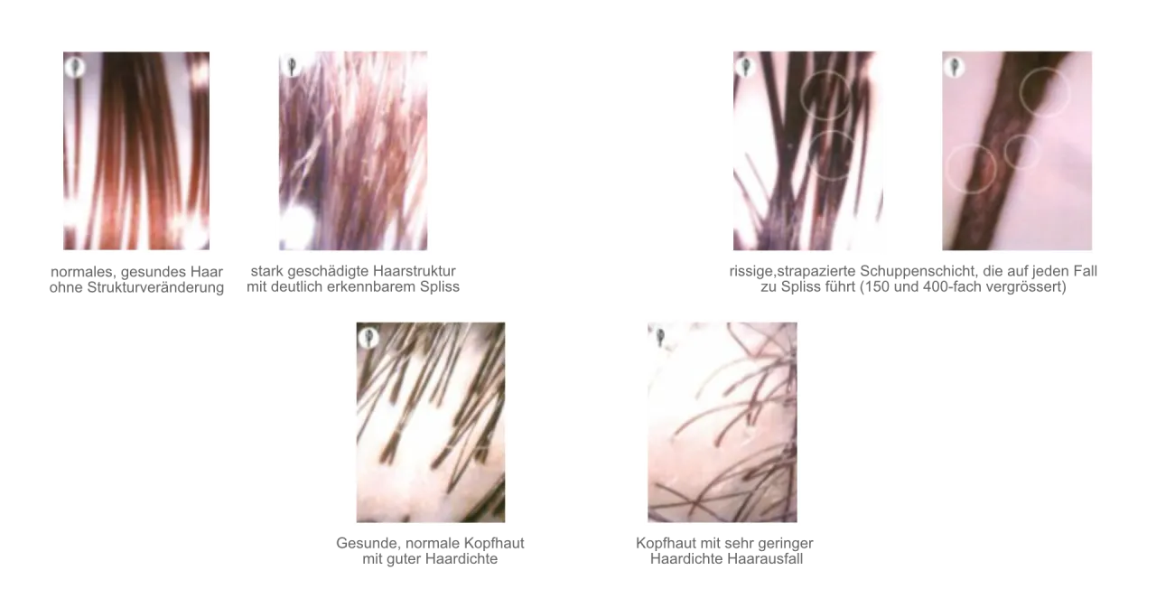 Gesundes Haar Nahaufnahme oder Haarstruktur Mikroskop
