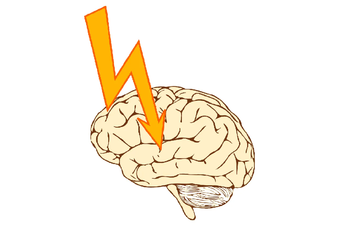 Mózg z zaznaczonymi obszarami uszkodzeń po udarze