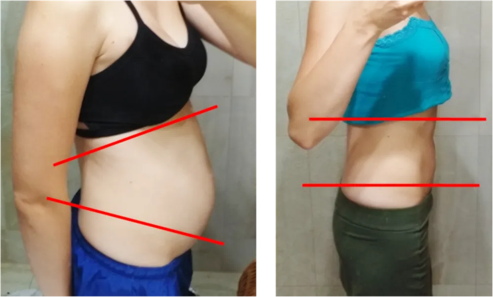 regeneracja mięśni brzucha