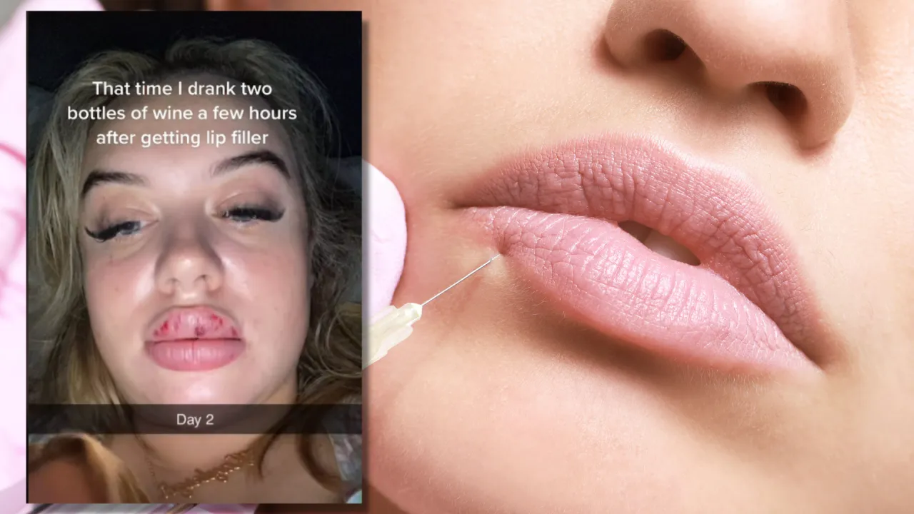 kwas hialuronowy alkohol skutki