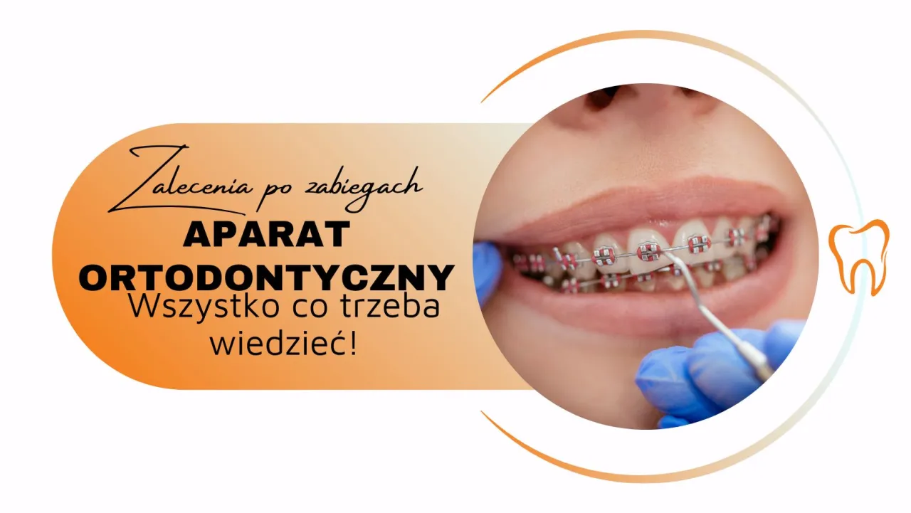 Produkty zakazane z aparatem ortodontycznym grafika