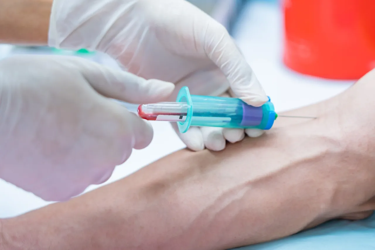 Laboratorium medyczne pobieranie krwi do badania OB