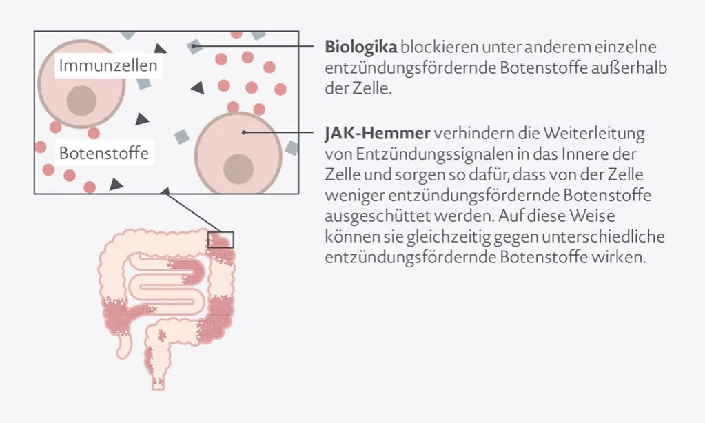 Moderne Medikamente Morbus Crohn Biologika