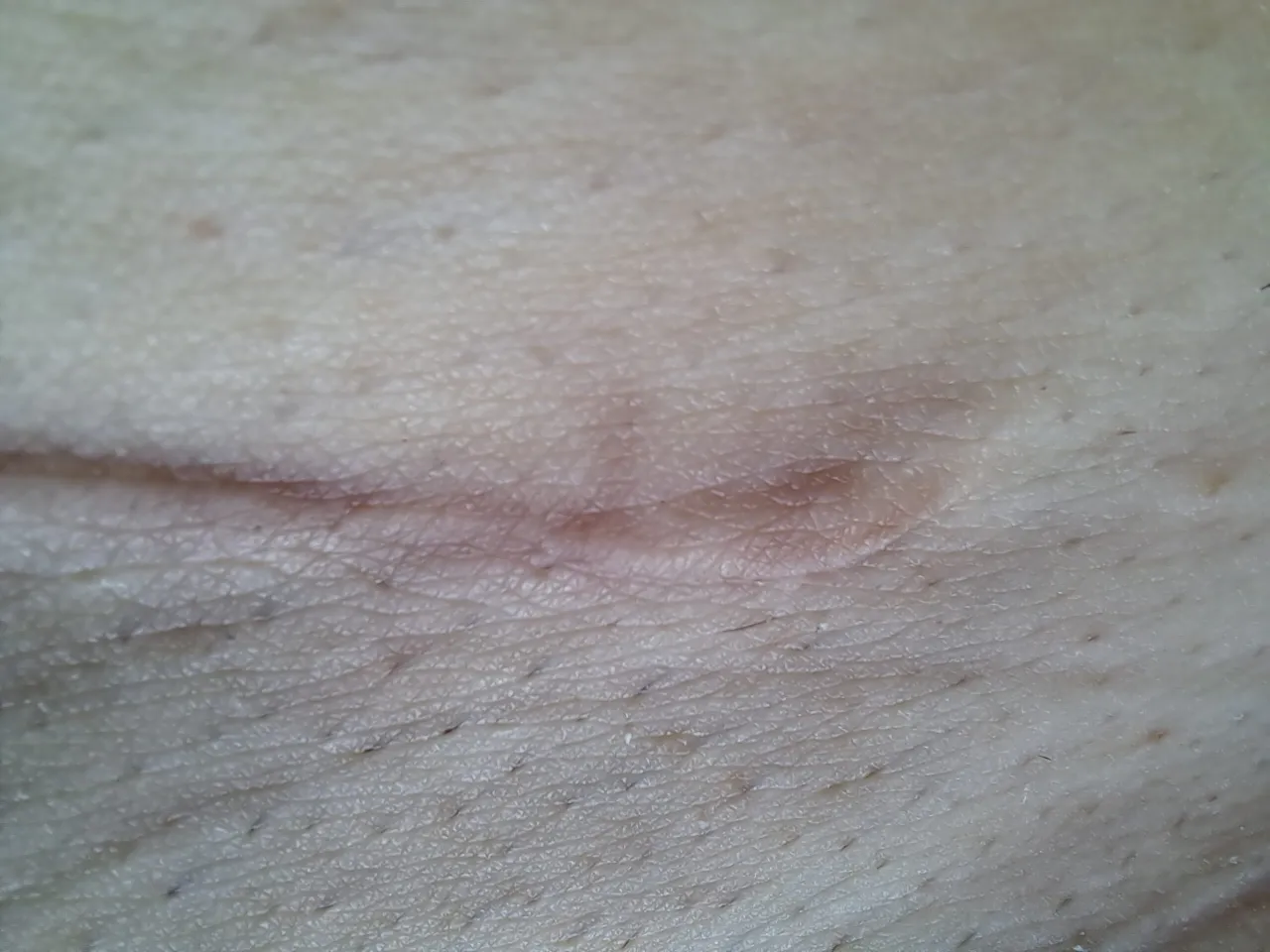 proces gojenia rany na sk&oacute;rze