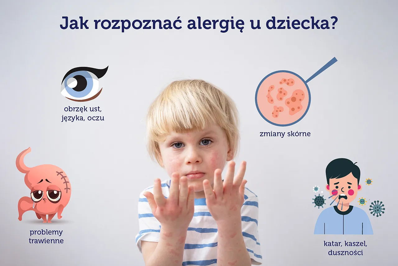 Zdjęcie Jak rozpoznać alergię? Objawy, diagnoza i sposoby leczenia