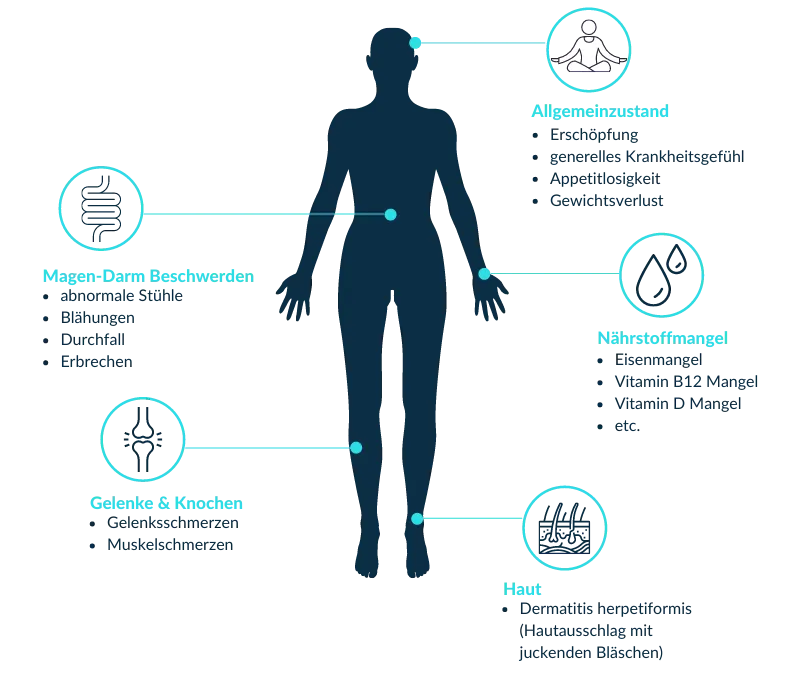 Zdjęcie Symptome Glutenunverträglichkeit: So erkennen Sie versteckte Anzeichen