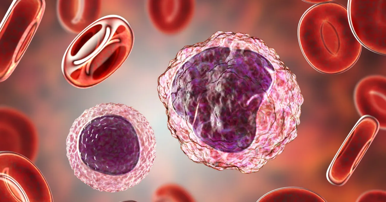 Zdjęcie Podwyższone monocyty: Co oznaczają? Kiedy do lekarza?
