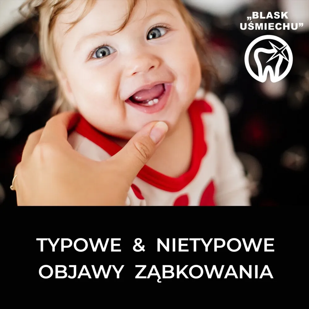 Zdjęcie Nietypowe objawy ząbkowania – kiedy to może być powód do niepokoju?