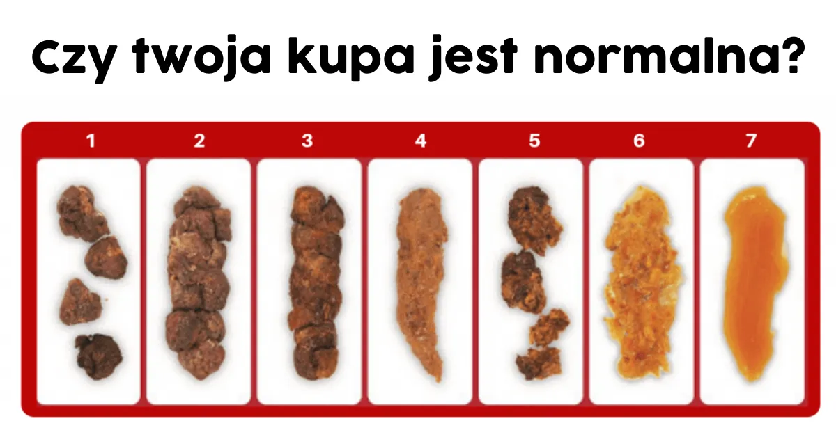 Zdjęcie Pomarańczowa kupa u psa: Co może oznaczać i jak postępować?