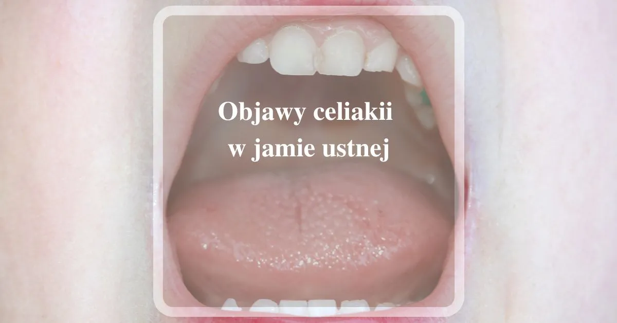Zdjęcie Jak sprawdzić uczulenie na gluten i uniknąć nieprzyjemnych objawów