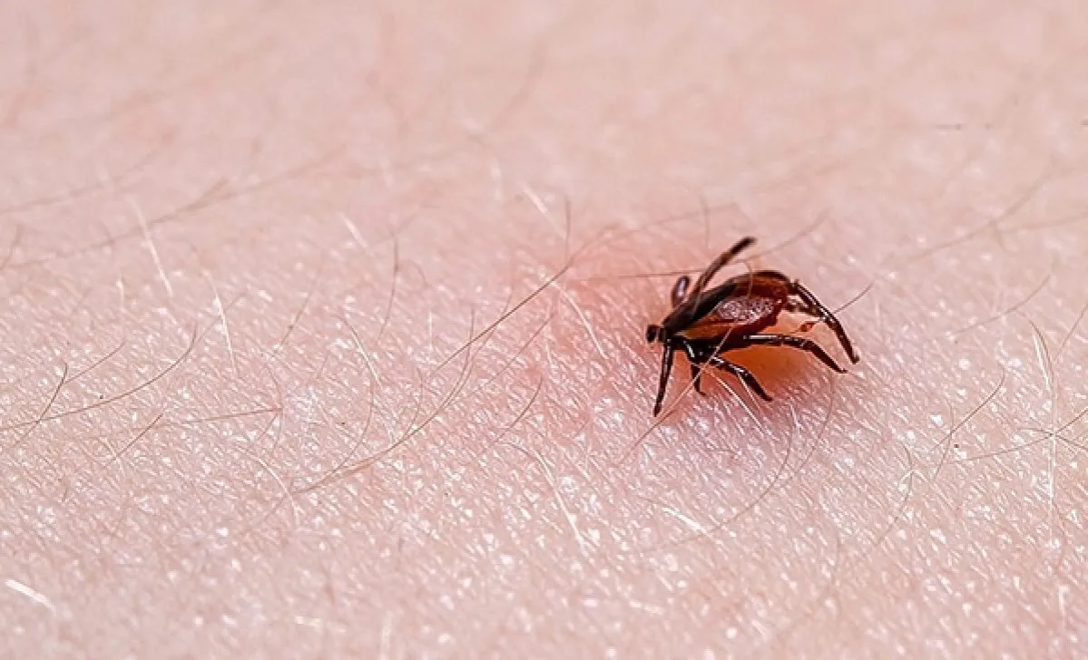 Zdjęcie Cómo es la picadura de una garrapata y qué síntomas debes conocer