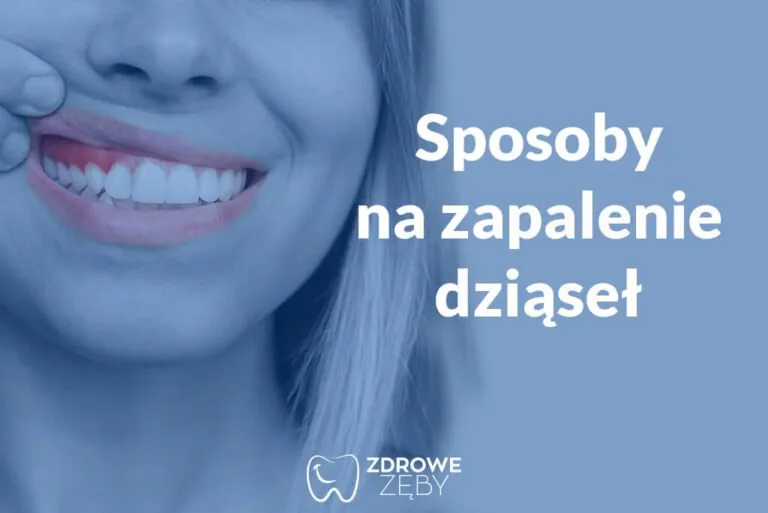 Zdjęcie Bezpieczne sposoby na zapalenie dziąseł w ciąży – jak uniknąć bólu i problemów
