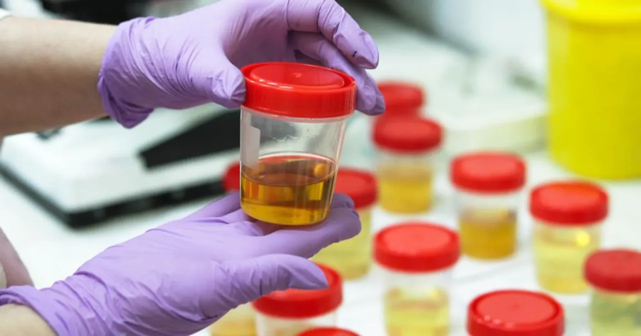 Zdjęcie Ile moczu jest potrzebne do badania? Kluczowe informacje, które musisz znać