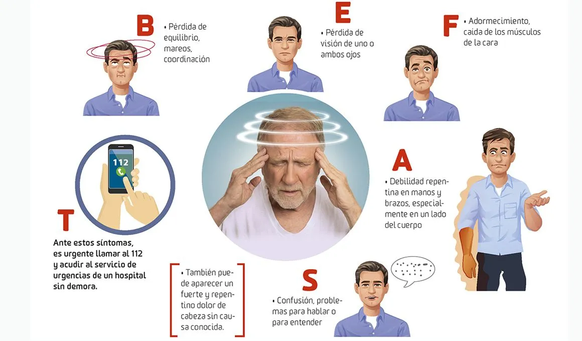Zdjęcie Síntomas de un ictus: Reconoce los signos que pueden salvar vidas
