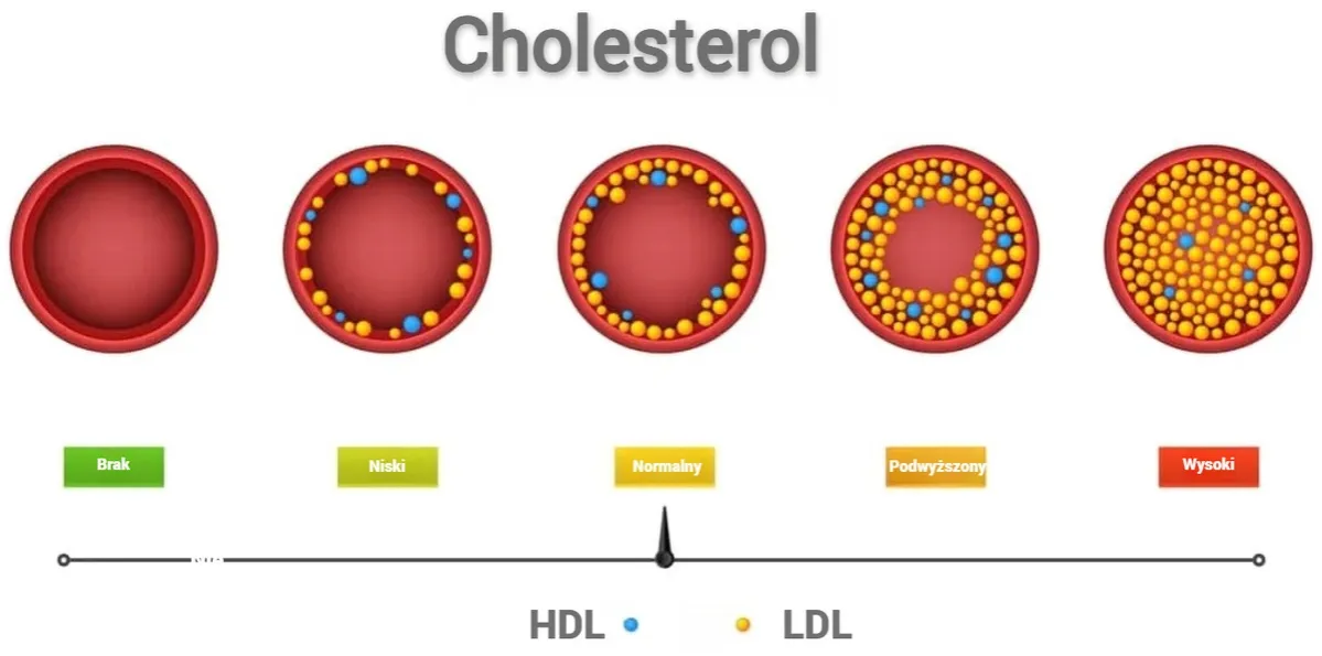 Zdjęcie Czy cholesterol HDL jest dobry czy zły? Poznaj jego wpływ na zdrowie