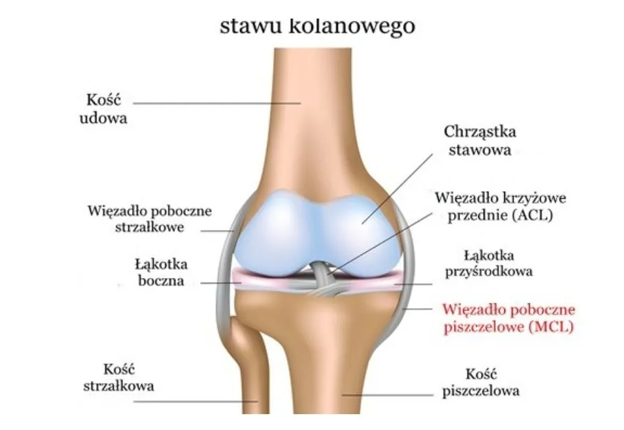 Zdjęcie Naciągnięte więzadła w kolanie: 7 objawów, które musisz znać