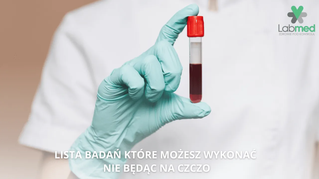 Zdjęcie Badanie potasu czy na czczo? Kluczowe zasady przygotowania i wyniki