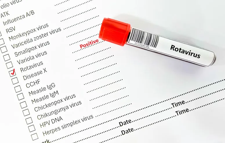 Zdjęcie Objawy rotawirusa u dorosłego – jak je rozpoznać i kiedy działać