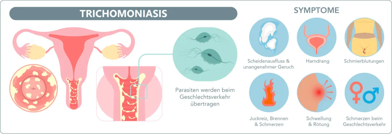 Zdjęcie Symptome von Geschlechtskrankheiten: Warnsignale, die Sie kennen sollten