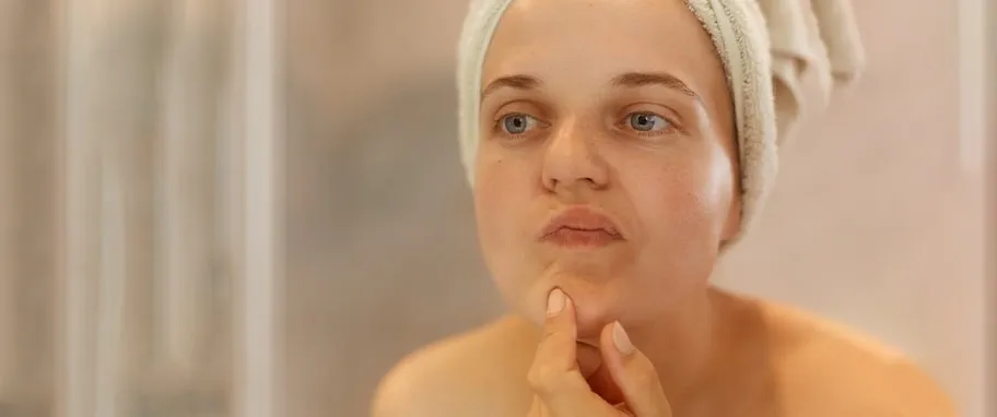 Zdjęcie Jak zagoic pryszcza: skuteczne metody na szybkie gojenie i redukcję widoczności