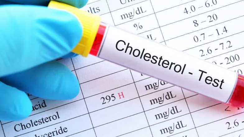 Zdjęcie Wysoki cholesterol a zdrowie: Jakie groźby mogą cię zaskoczyć?
