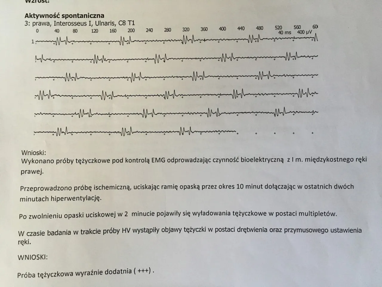 Zdjęcie Badania na tężyczkę - jakie testy potwierdzają diagnozę?