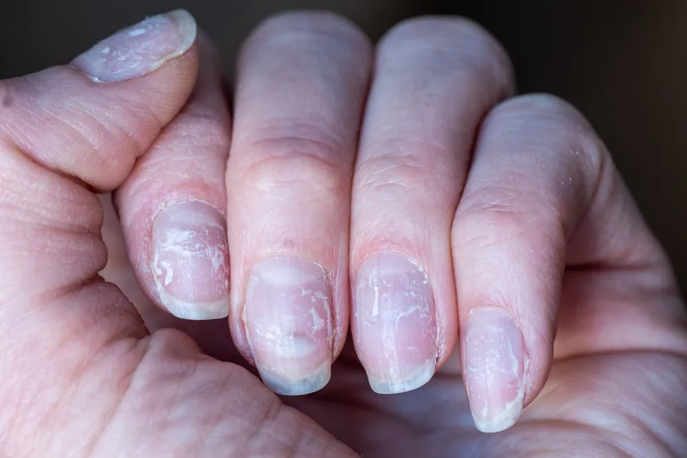 Zdjęcie Jak naprawić manicure hybrydowy - proste sposoby na trwały efekt