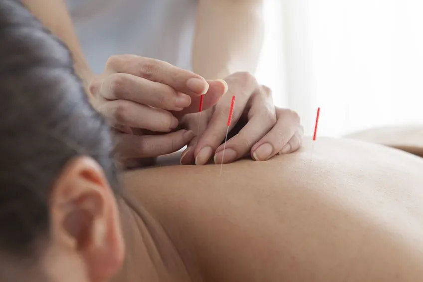 Zdjęcie Akupunktura na depresję: Czy to skuteczna terapia wspomagająca?