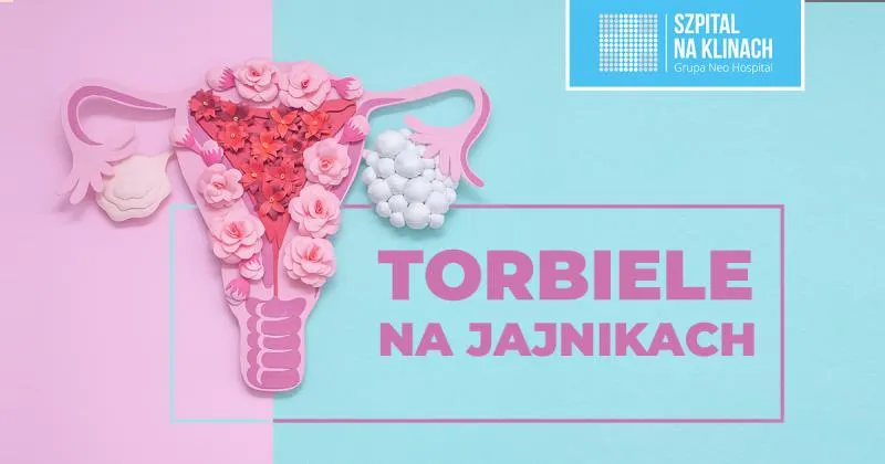 Zdjęcie Jakie leki hormonalne na torbiel jajnika mogą skutecznie pomóc?