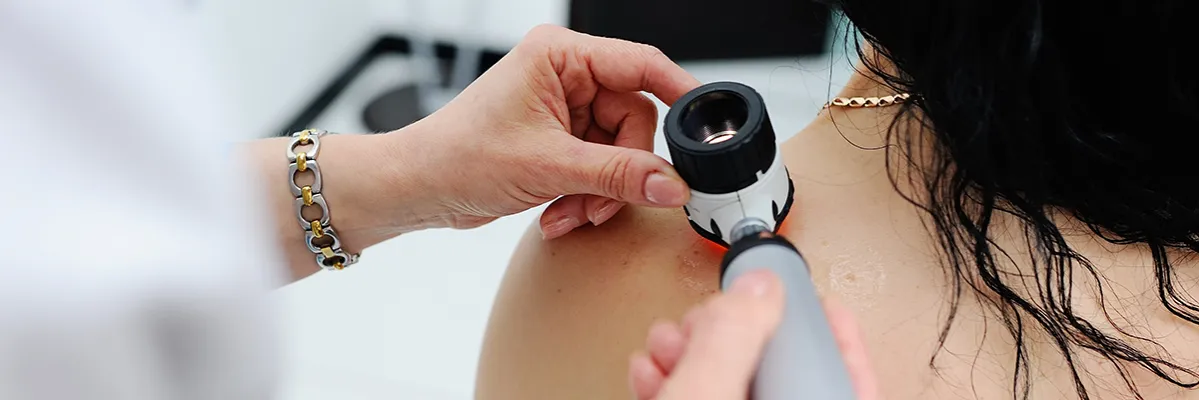 Zdjęcie Dermatolog NFZ - Czy naprawdę potrzebne jest skierowanie?