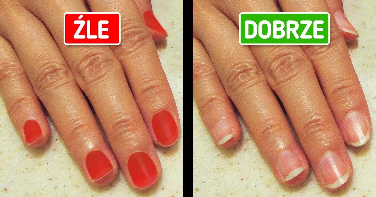 Zdjęcie Czego absolutnie unikać przed wizytą u ginekologa? Praktyczne porady
