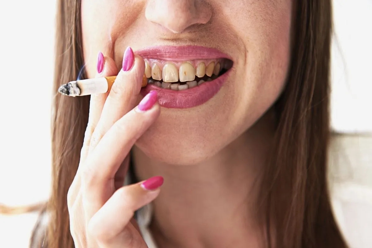 Zdjęcie Powiększanie ust a palenie: kiedy można wrócić do nałogu?