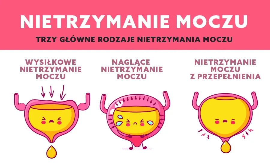 Zdjęcie Wysiłkowe nietrzymanie moczu: skuteczne sposoby leczenia