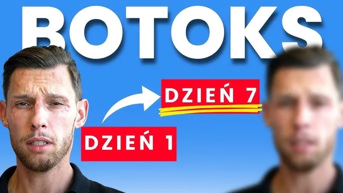Zdjęcie Jak szybko widać efekty botoksu na lwia zmarszczkę? Czas oczekiwania