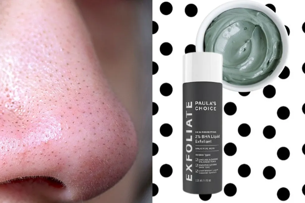 Zdjęcie Jak usunąć wągry z nosa u dziecka - bezpieczne metody i porady