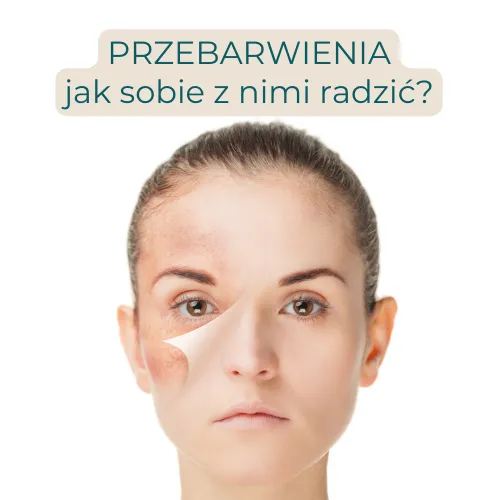 Zdjęcie Jak uzupełnić niedobór melaniny i poprawić wygląd skóry?