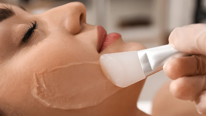 Zdjęcie Peeling fenolowy ile się goi: co musisz wiedzieć o regeneracji skóry