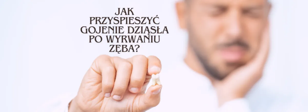 Zdjęcie Jak przyspieszyć gojenie dziąsła po wyrwaniu zęba i uniknąć bólu