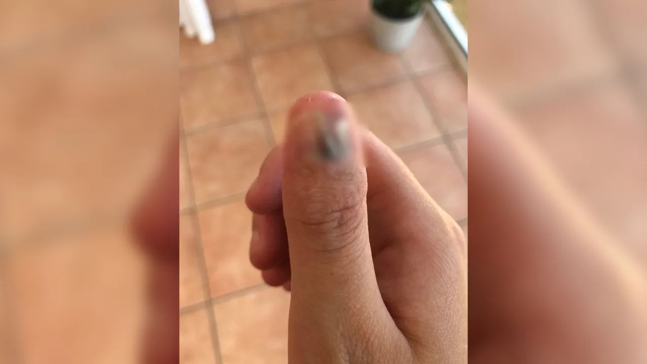 Zdjęcie Dlaczego obgryzasz paznokcie? Przyczyny, skutki i jak przestać