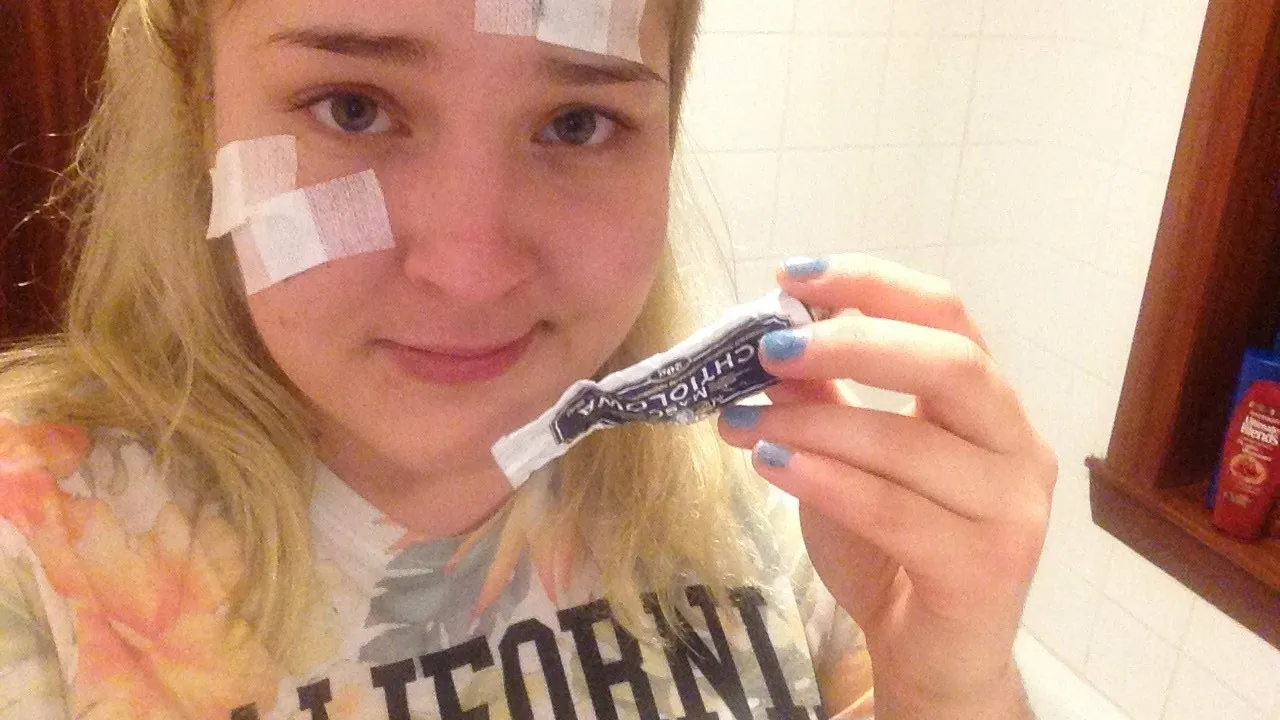 Zdjęcie Maść ichtiolowa na pryszcz: Ile trzymać? Sprawdź!