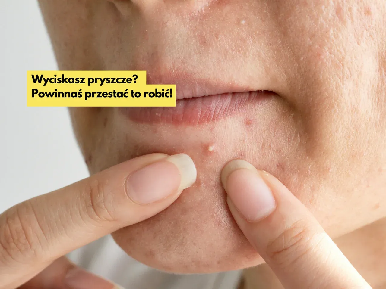 Zdjęcie Dlaczego lubię oglądać wyciskanie pryszczy? Psychologia przyjemności