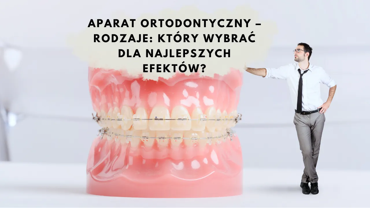 Zdjęcie Jakie są aparaty na zęby? Poznaj różnice i wybierz najlepszy dla siebie