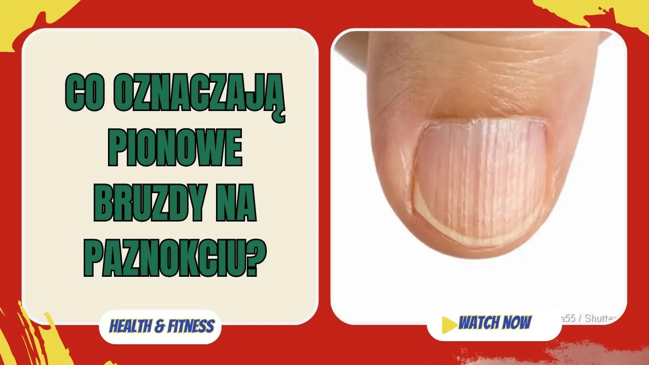 Zdjęcie Co oznaczają bruzdy na paznokciach? Poznaj przyczyny i zagrożenia