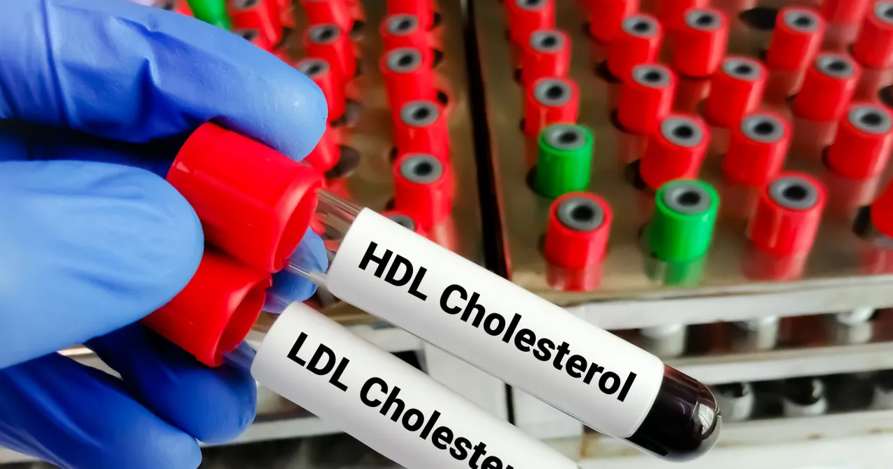 Zdjęcie Jak obliczyć cholesterol resztkowy i uniknąć ryzyka zdrowotnego