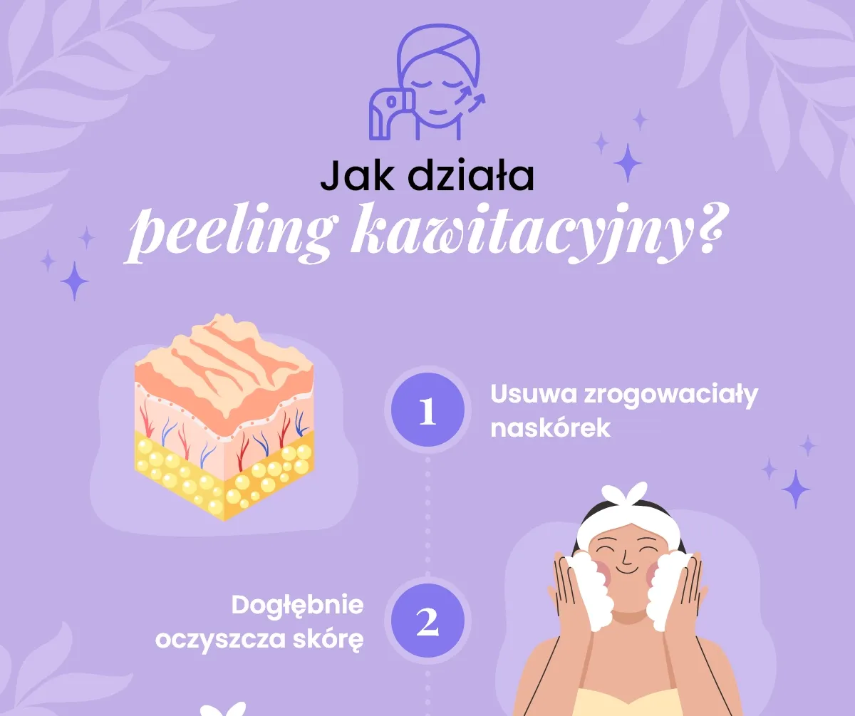 Zdjęcie Jak działa peeling kawitacyjny: Sekrety skutecznego zabiegu