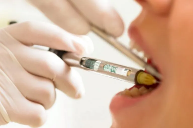 Zdjęcie Czy znieczulenie u dentysty boli? Jak uniknąć dyskomfortu podczas zabiegu