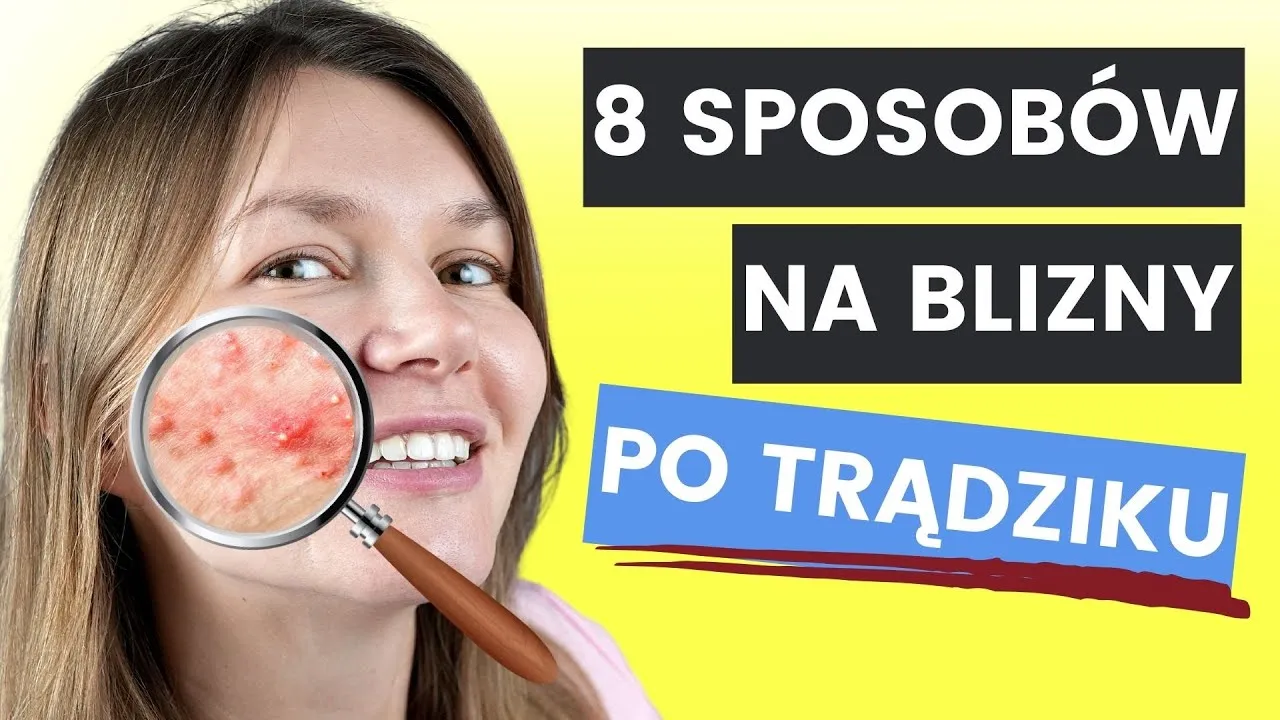 Zdjęcie Skuteczne metody na blizny po pryszczach – jak je zredukować?