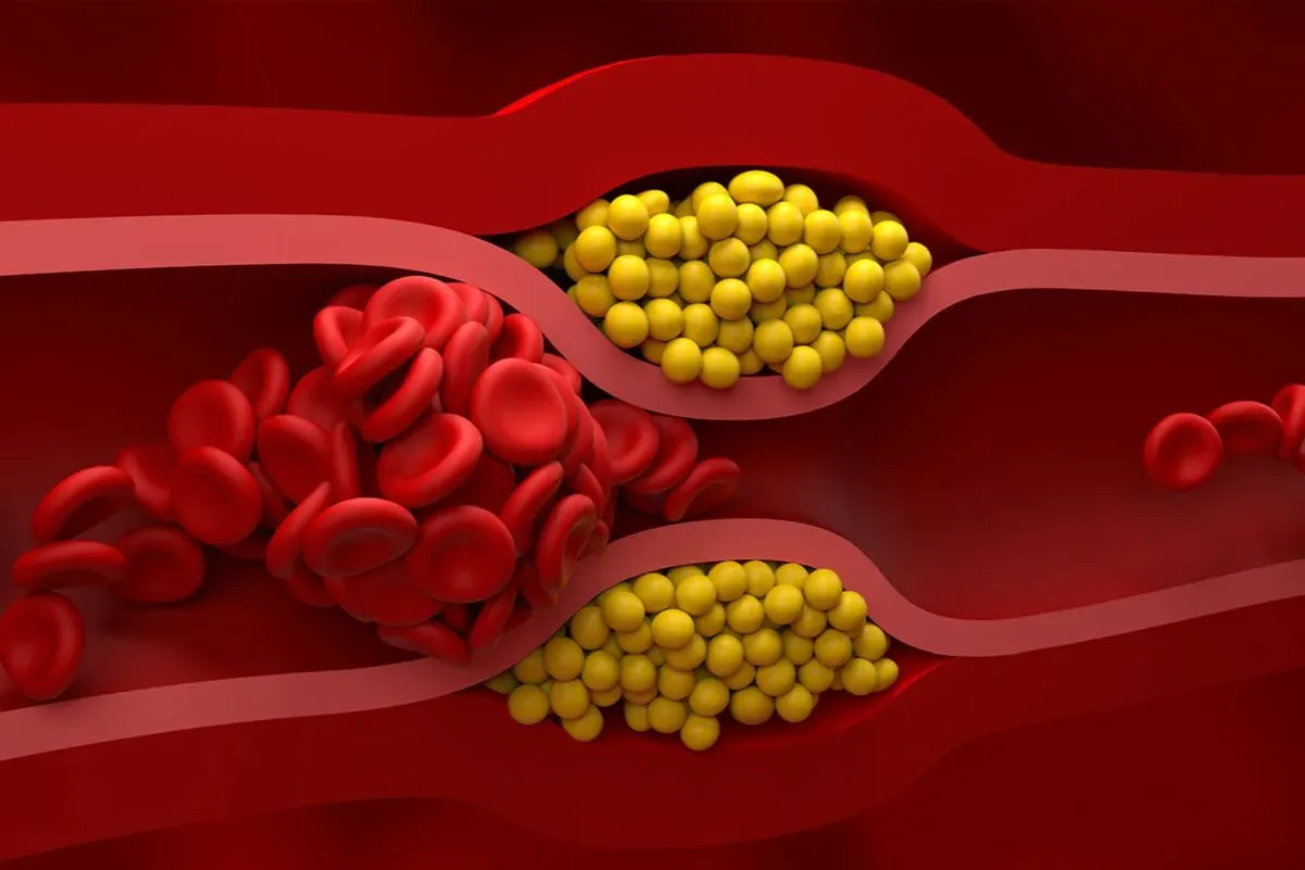 Zdjęcie Jak podwyższyć cholesterol nie-HDL i poprawić zdrowie serca