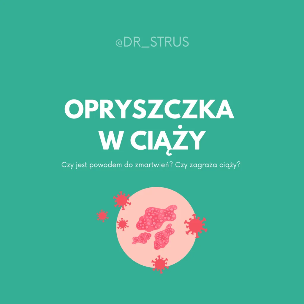 Zdjęcie Jak długo kotka chodzi w ciąży? Fakty, które musisz znać